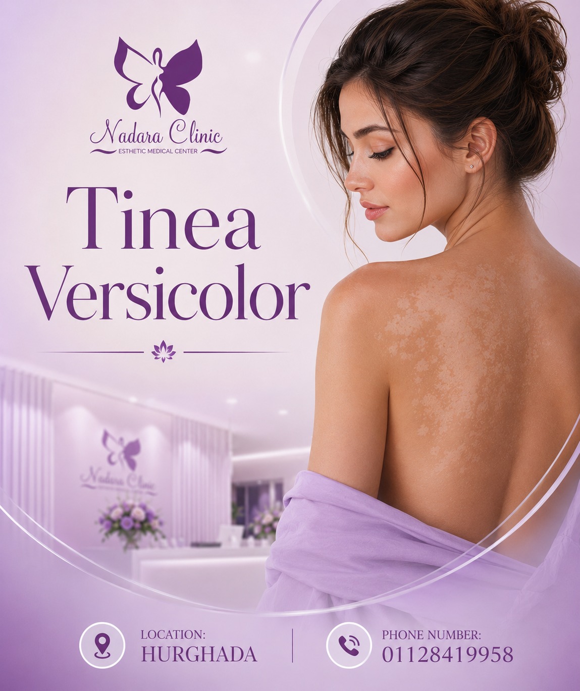 The colorful tinea in Hurghada